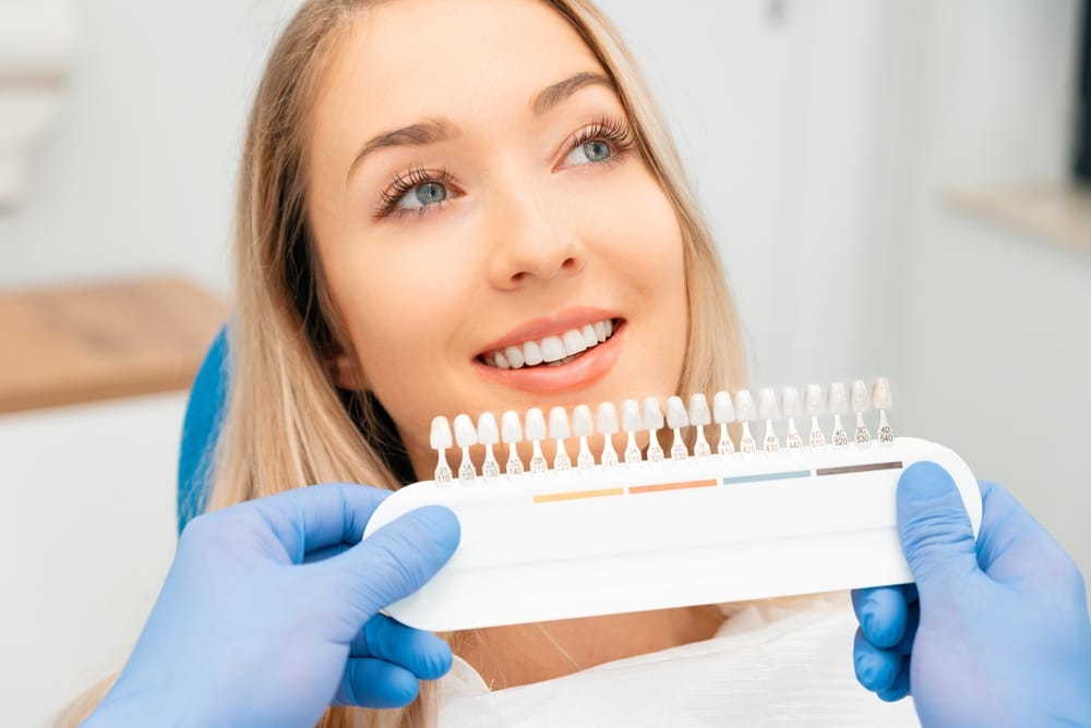 Choosing a shade of dental veneers - Veneers in Tucson AZ