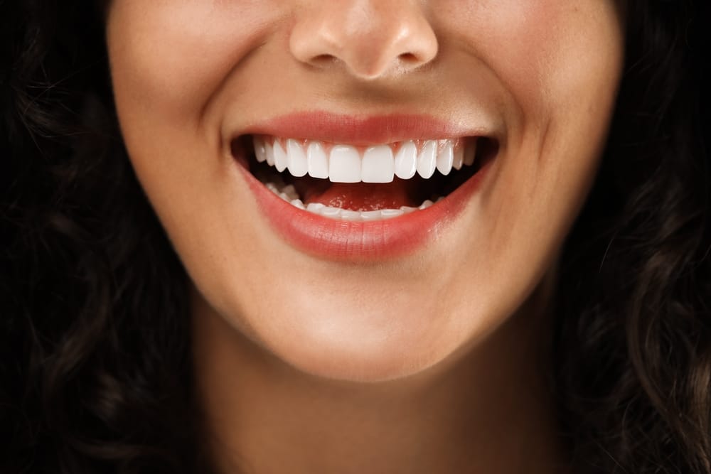 Dental veneers - Tooth Implant Tucson AZ
