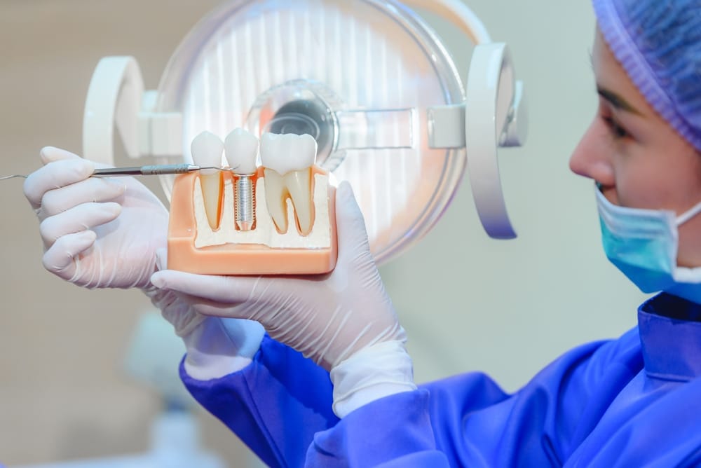 Dentist showing human teeth model and pointing to crown of Dental Implant - Tucson Dental Crowns