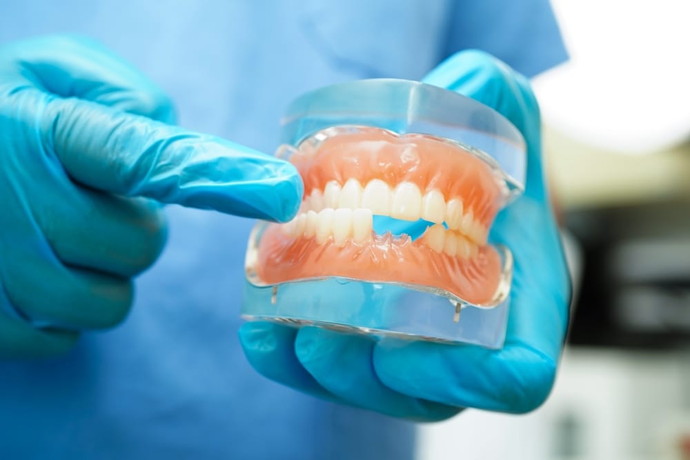 Dentist holding a teeth model - Dentures Oro Valley AZ