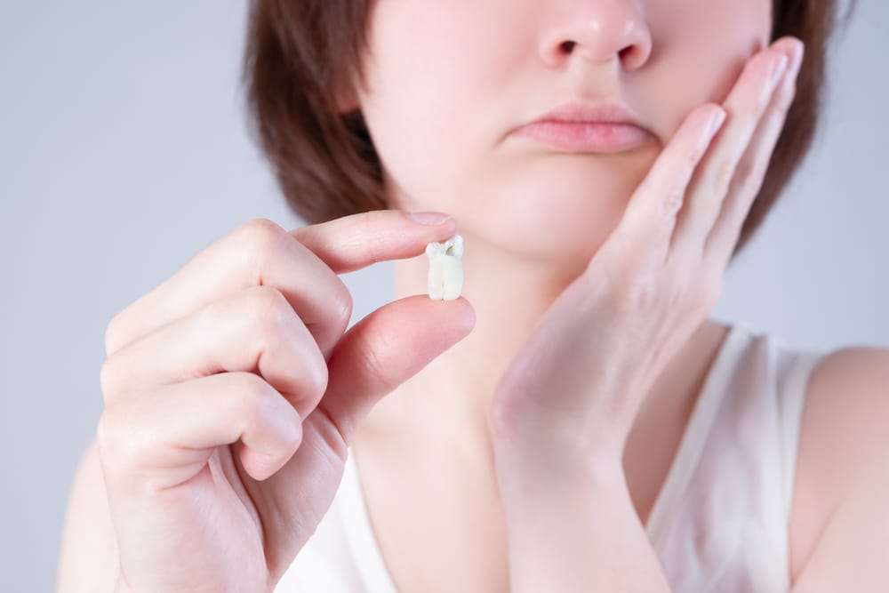 Wisdom tooth extraction - Tooth Extraction Oro Valley
